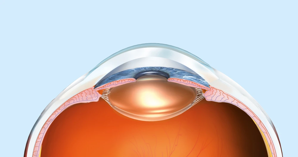 Chirurgies - Solutions chirurgicales avancées - OPHTA CMC LEMAN Chirurgies - Solutions chirurgicales avancées - OPHTA CMC LEMAN