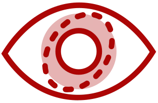 Icon-Opération laser - Hypermétropie -Ophta-CMC-LEMAN